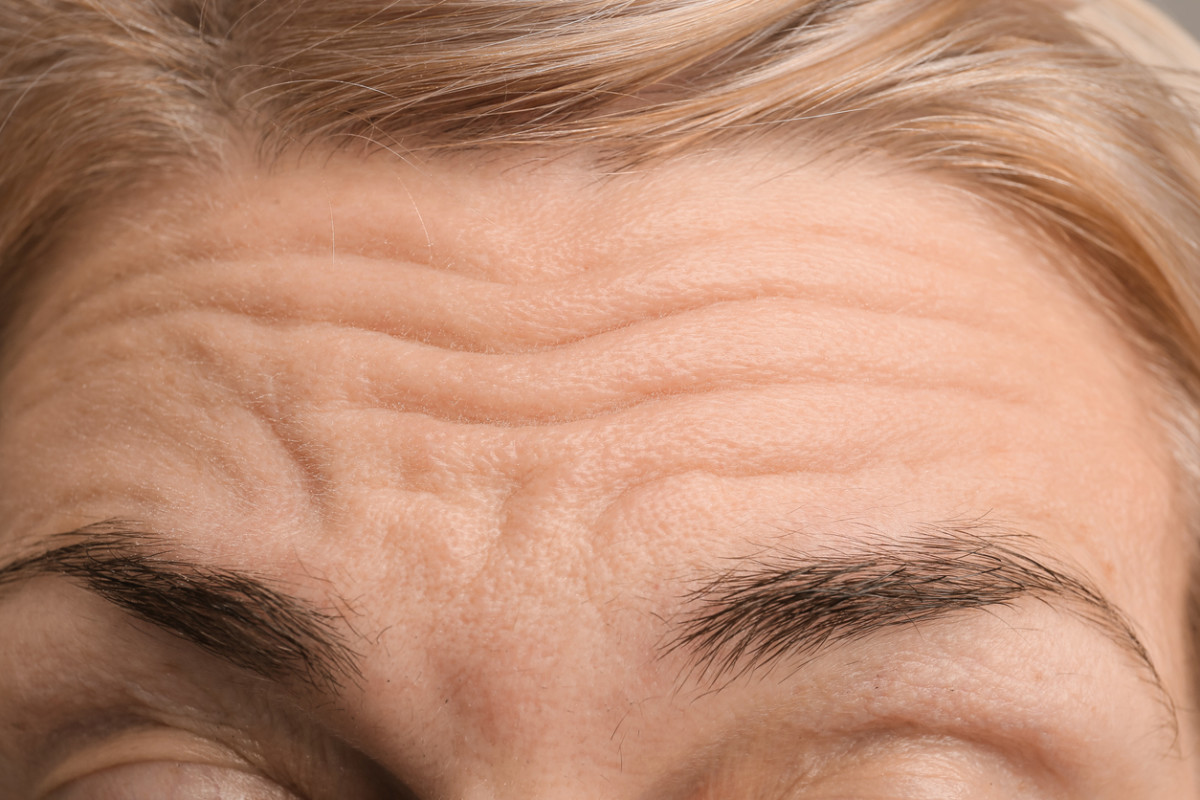 Smooth skin tips for forehead wrinkles