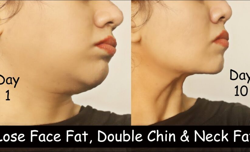 Effective Ways to Lose Neck Fat in 2025: Discover Proven Techniques for a Slimmer Look!