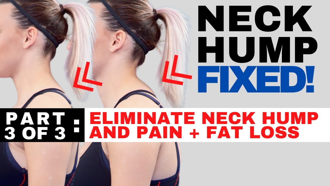 Proven Techniques for a Slimmer Neck