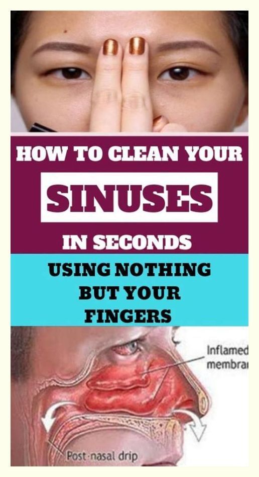 Effective Ways to Clear Your Sinuses for Better Breathing in 2025